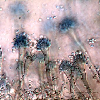 Mikroskopická zvětšenina plísně